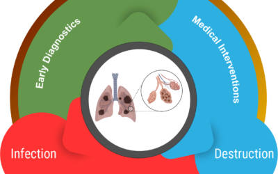 Mechanisms of Nanocarbon Black and RSV mediated inflammation in COPD using human airway Organoid model.