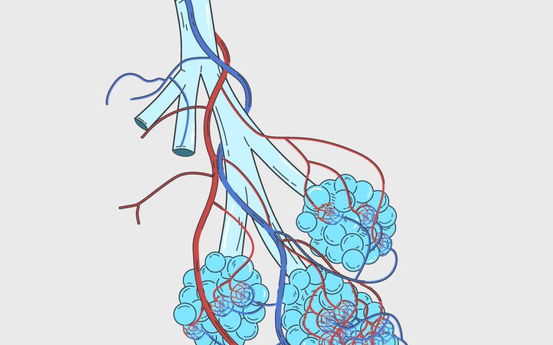 Role of nCB and RSV in Acute Exacerbation of Airway Inflammation